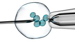 What to Consider When Choosing a Preimplantation Genetic Testing (PGT) Platform What to Consider When Choosing a Preimplantation Genetic Testing (PGT) Platform