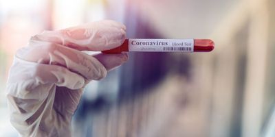 A vial of blood with COVID-19