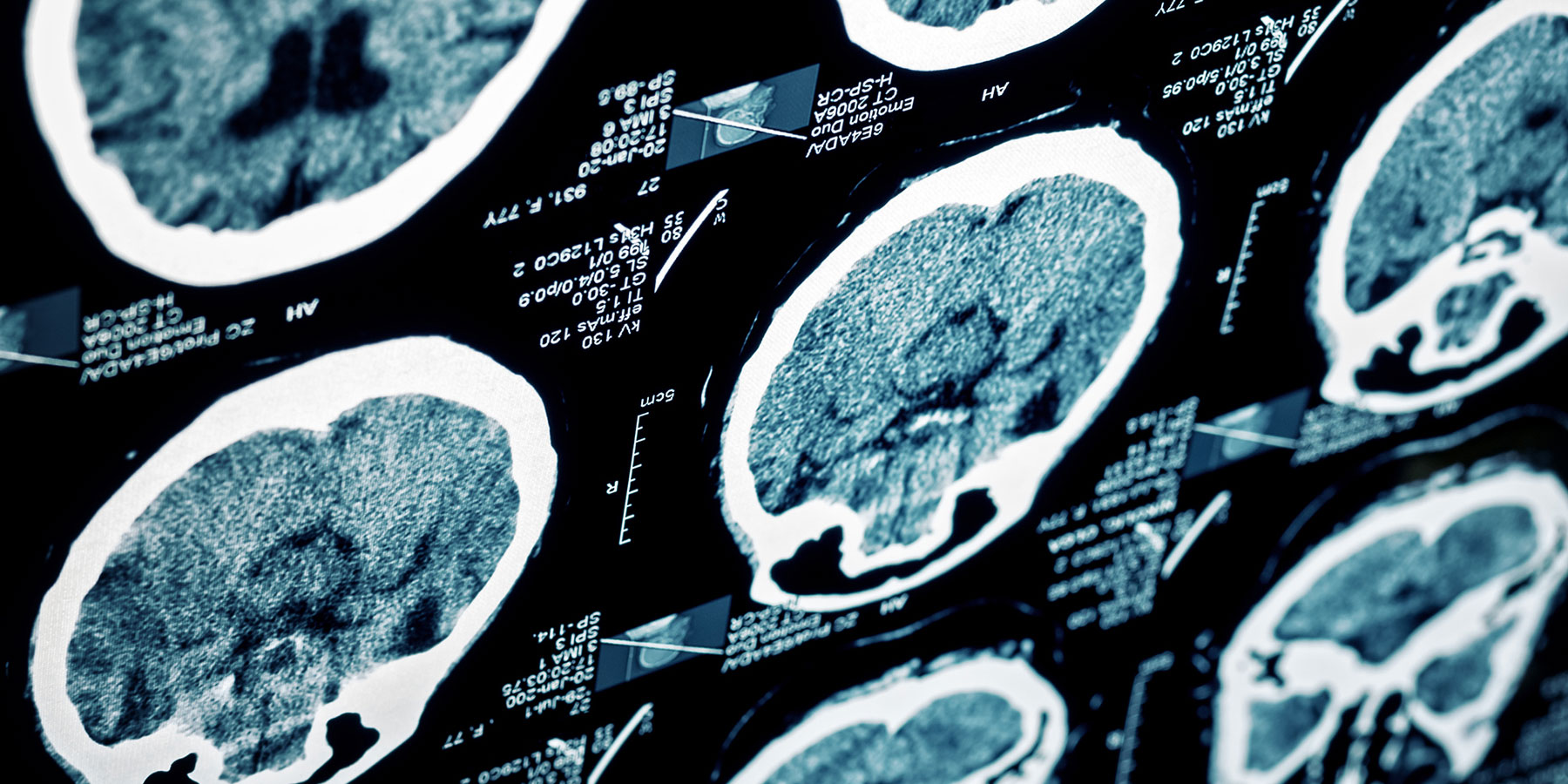 picture of a brain scan