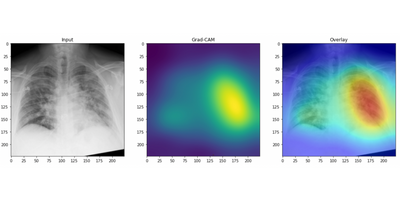 Chest X-ray of COVID-19 positive patient