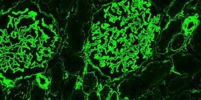 Heparan Sulfate Products for COVID-19 Infection, Disease, &amp; Therapeutics Research