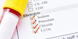 A tube of blood next to a list of electrolytes 