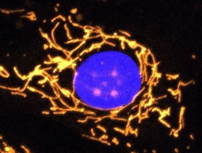 Fluorescent microscope image with mitochondria dotting the inside of the cell