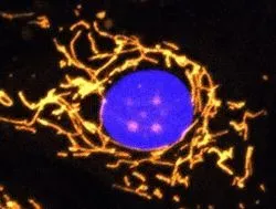 Fluorescent microscope image with mitochondria dotting the inside of the cell