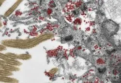 Electron microscopy image of small round coronavirus particles infecting brain tissue