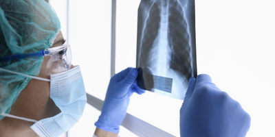 A clinical technician wearing PPE holds up a lung X-ray