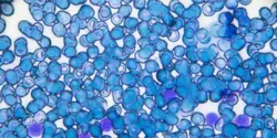 Microscopy Image of Cancer Cells