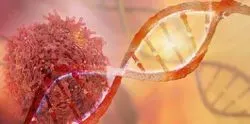 Ovarian Cancer Project Shows Promise