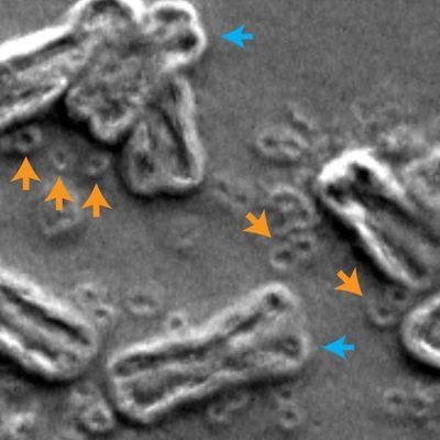 scanning electron micrograph of inside the nucleus of a cancer cell