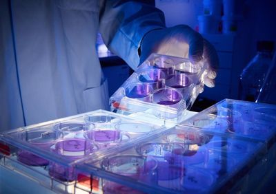 Photo of cell culture plates with stained cells, in which virus replication can be quantified by the ‚holes' that virus infection causes in the cell lawn.