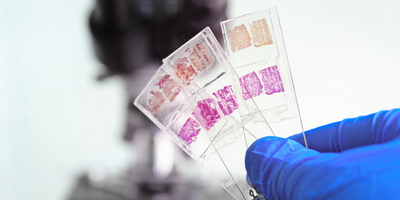 A photo of a lab technician wearing PPE holding glass tissue histology slides