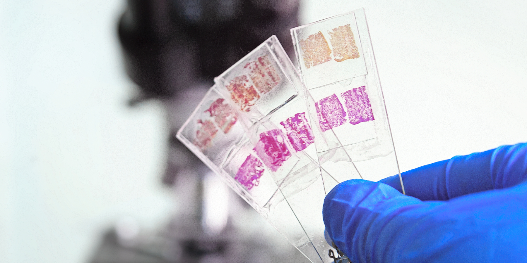 A photo of a lab technician wearing PPE holding glass tissue histology slides