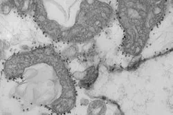 A photo of damaged mitochondria released from human lungs