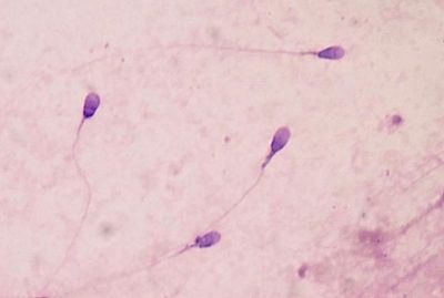 Human sperm stained for semen quality testing in the clinical laboratory