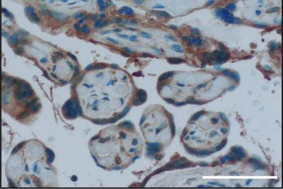 Human placental cells were stained to indicate the presence of an estrogen receptor called GPER1, which helps protect the fetus from the immune response to viral infection
