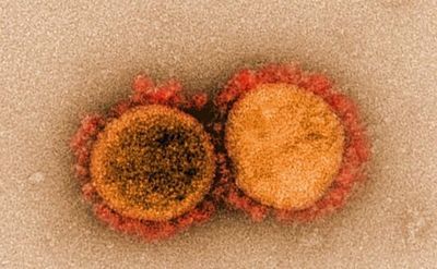 Transmission electron micrograph of SARS-CoV-2 virus particles, isolated from a patient. Image captured and color-enhanced at the NIAID Integrated Research Facility (IRF) in Fort Detrick, Maryland.
