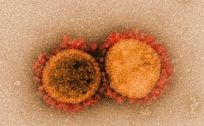 Transmission electron micrograph of SARS-CoV-2 virus particles, isolated from a patient. Image captured and color-enhanced at the NIAID Integrated Research Facility (IRF) in Fort Detrick, Maryland.