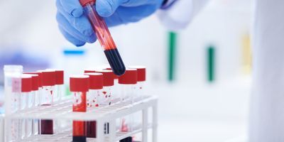 clinical laboratory professional wearing PPE and handling a vial of blood