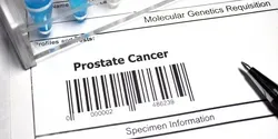 Image of the words prostate cancer above a genomic bar code