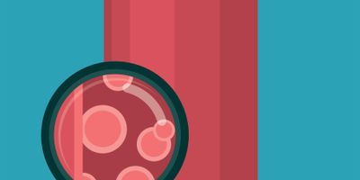 Spotlight on Standardization Programs for Blood Cholesterol Testing