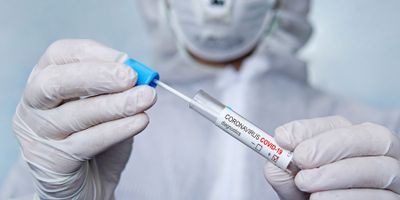 IVDR—The Impact of COVID-19