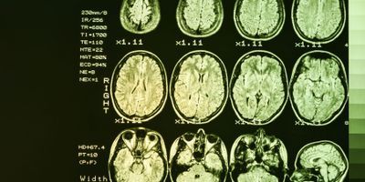 MRI human brain scans