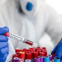 Clinical laboratory scientist wearing PPE sorting covid-19 blood samples