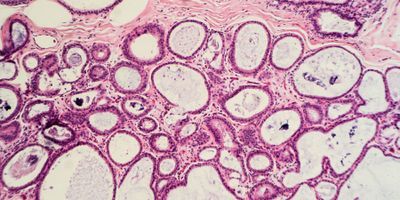 Photo of a histology slide showing tissue architecture of placenta