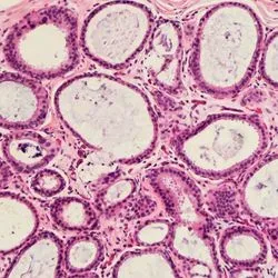Photo of a histology slide showing tissue architecture of placenta