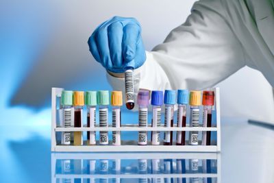 Preanalytical Automation in the Clinical Lab