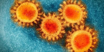 Cryo-electron micrograph photo of the novel coronavirus colored to show the spike proteins on the surface of the virus