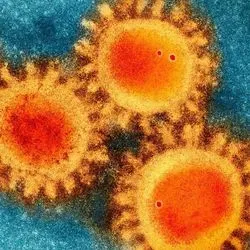 Cryo-electron micrograph photo of the novel coronavirus colored to show the spike proteins on the surface of the virus