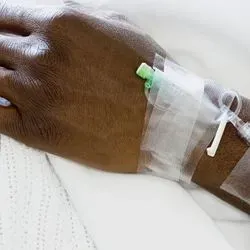 Photo of a Black cancer patient's hand with an IV tube
