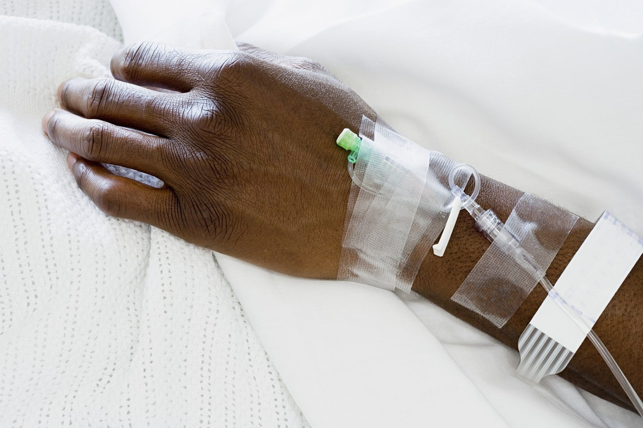 Photo of a Black cancer patient's hand with an IV tube