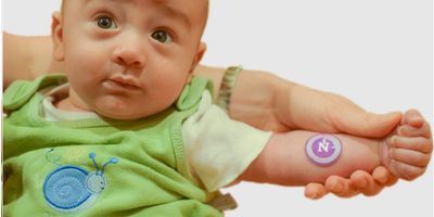 Photo of a baby wearing the "sweat sticker" on its arm