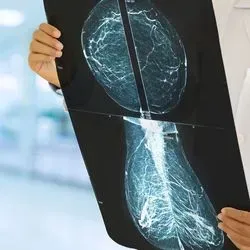 Health care professional holding an xray breast mammography in their hands