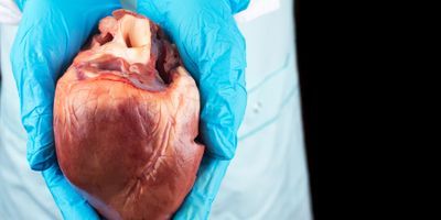 Photo of someone wearing blue lab gloves holding a human heart in their hands