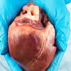 Photo of someone wearing blue lab gloves holding a human heart in their hands