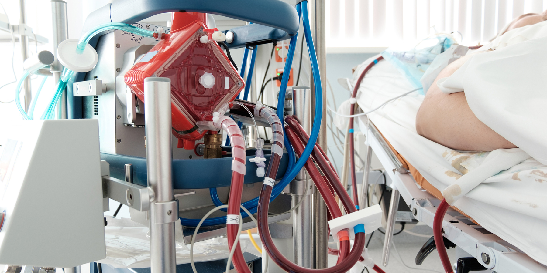 Photo of an ECMO machine filtering blood from a patient lying in a hospital bed