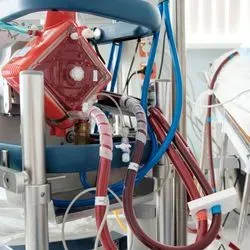Photo of an ECMO machine filtering blood from a patient lying in a hospital bed