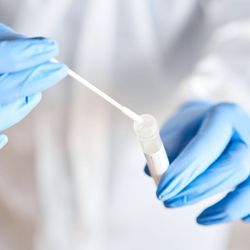 A Comparison of COVID-19 Point-of-Care Tests