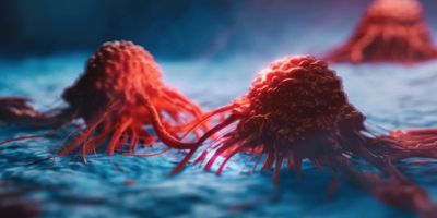 Illustration of two cancer cells with long tentacle-link structures