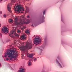 Illustration of cancer cells in colorectal cancer