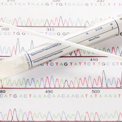 Do Cancer Genetic Testing Criteria Need an Overhaul?