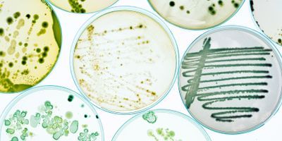 Photo of bacterial cultures in petri dishes