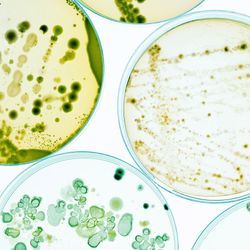 Photo of bacterial cultures in petri dishes