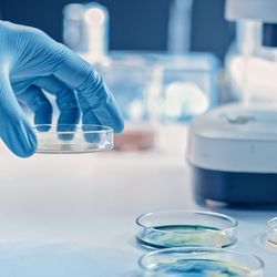 Photo of a clinical lab professional wearing PPE and holding a petri dish with CAR T cells in it on top of a lab bench