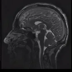 Photo of a sagittal cross-section of the human brain on a black background