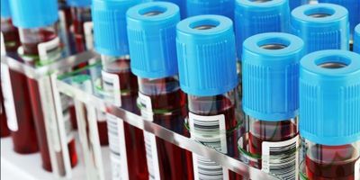 Photo of COVID-19 blood sample tubes with ID labels lined up in rows