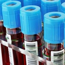 Photo of COVID-19 blood sample tubes with ID labels lined up in rows